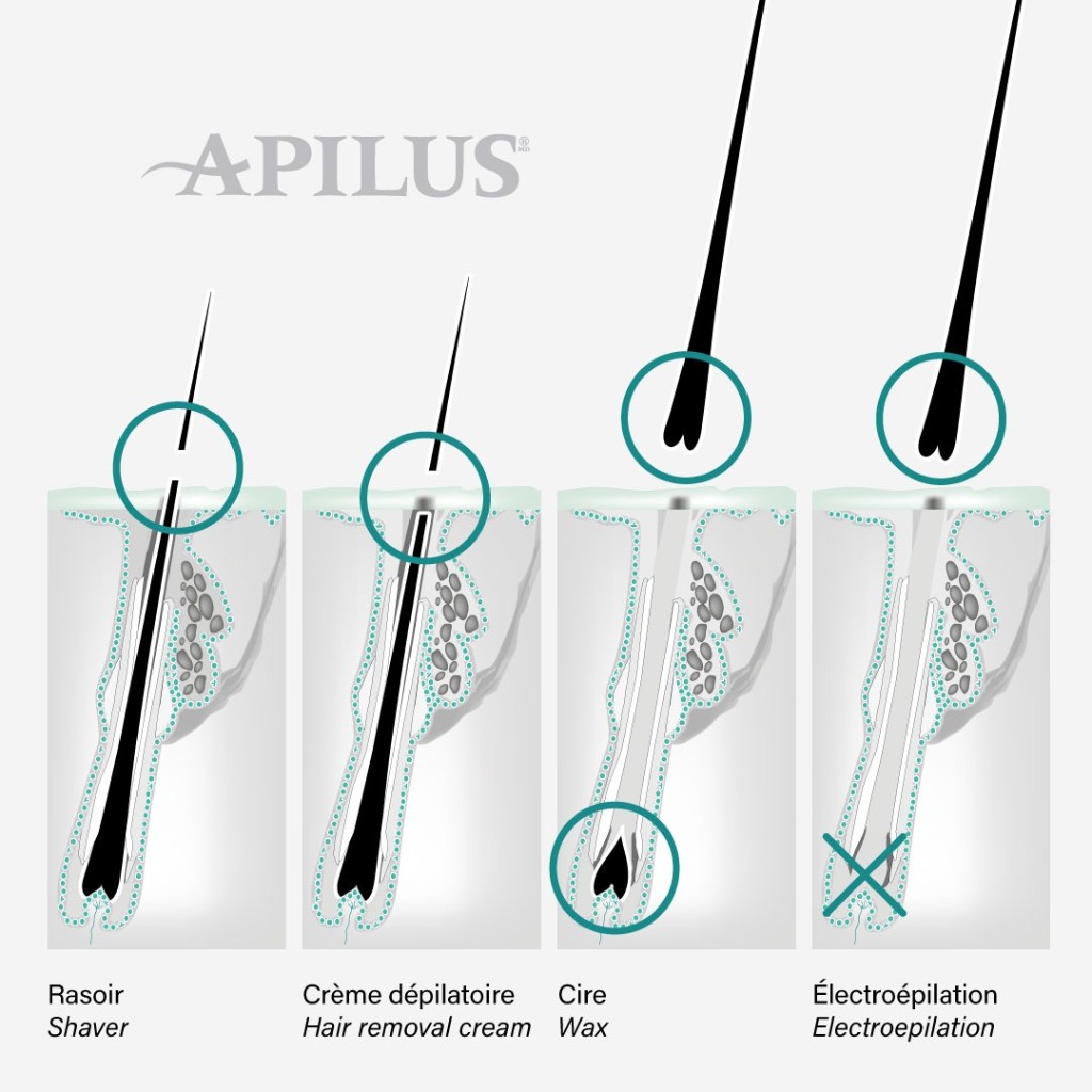 Comparaison Apilus : rasoir, crème dépilatoire, cire et électroépilation